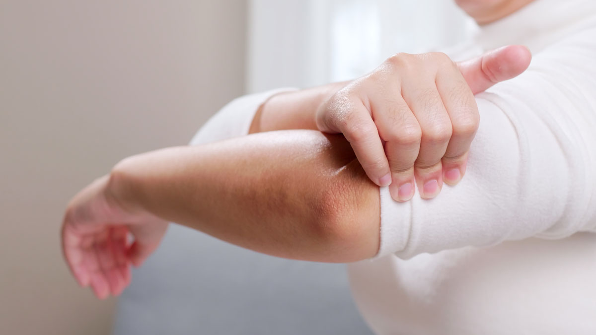 cubital tunnel syndrome